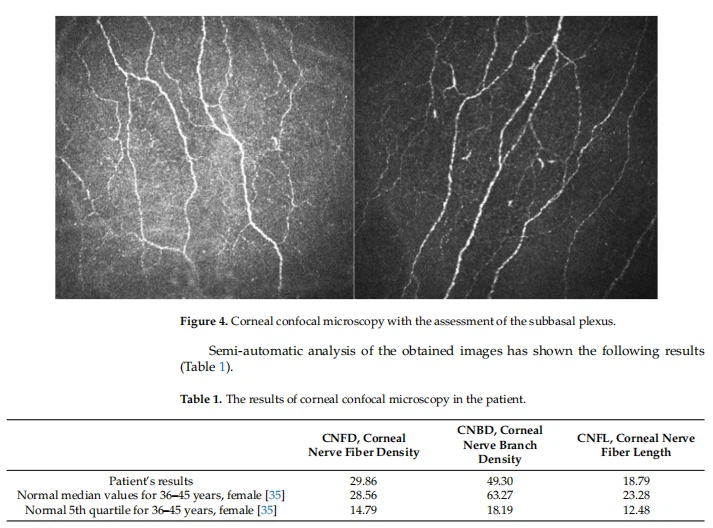 covid fatigue covid fatigue